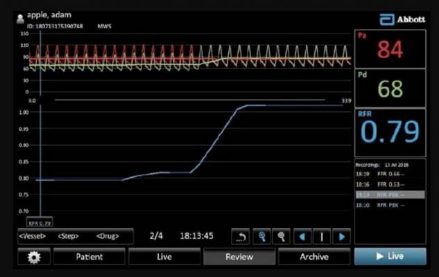 FDA Clears Abbott's New FFR Coronary Lesion Assessment Technology